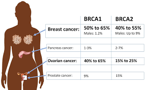BRCA mutation - Wikipedia
